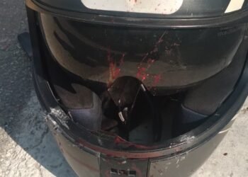 Jovem fica ferido em acidente no centro de Guabiruba